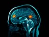 Hitachi Develops New Brain-Scan Interface