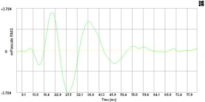 IR 80dB 1m